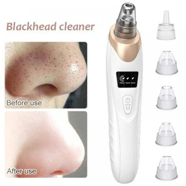 Multifunctional Blackhead Remover