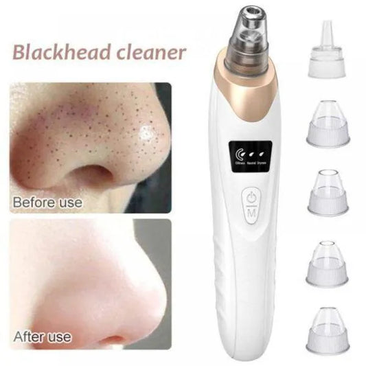 Multifunctional Blackhead Remover